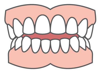 Common Orthodontic Problems